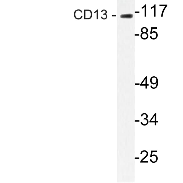 Western Blot - Anti-CD13 Antibody (R12-2065) - Antibodies.com