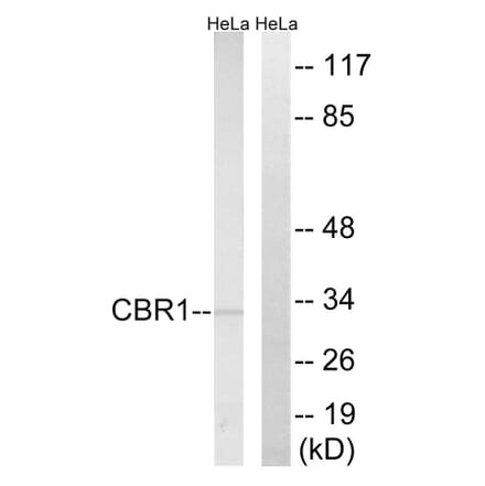 Western Blot - Anti-CBR1 Antibody (C14949) - Antibodies.com