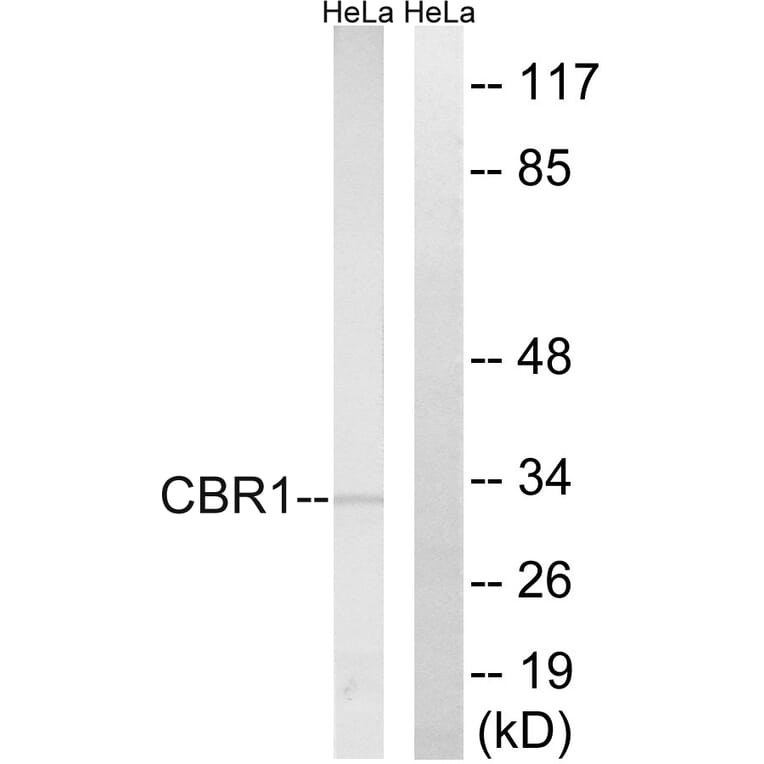 Western Blot - Anti-CBR1 Antibody (C14949) - Antibodies.com
