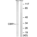 Western Blot - Anti-CBR1 Antibody (C14949) - Antibodies.com