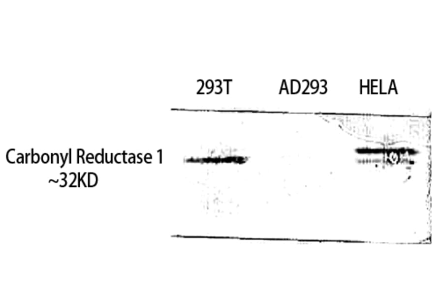 Western Blot - Anti-CBR1 Antibody (C14949) - Antibodies.com