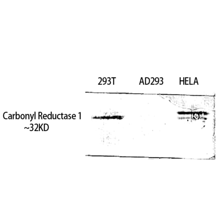 Western Blot - Anti-CBR1 Antibody (C14949) - Antibodies.com