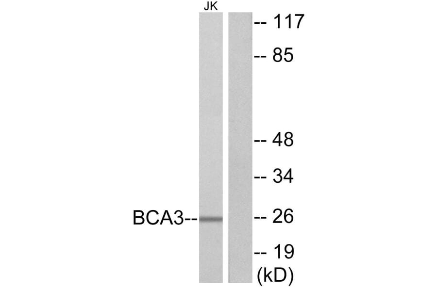 Western Blot - Anti-BCA3 Antibody (C11741) - Antibodies.com
