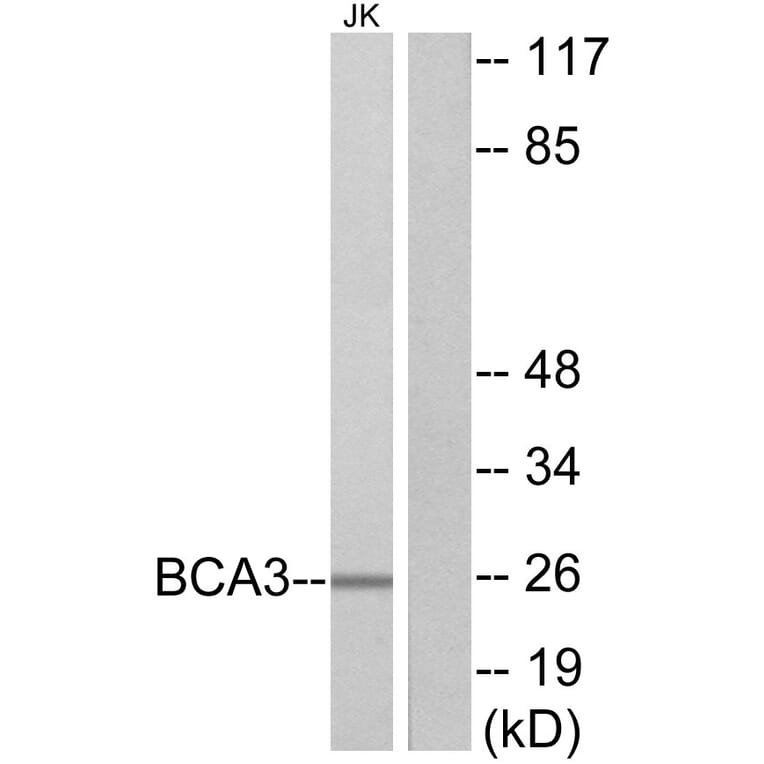 Western Blot - Anti-BCA3 Antibody (C11741) - Antibodies.com