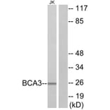 Western Blot - Anti-BCA3 Antibody (C11741) - Antibodies.com