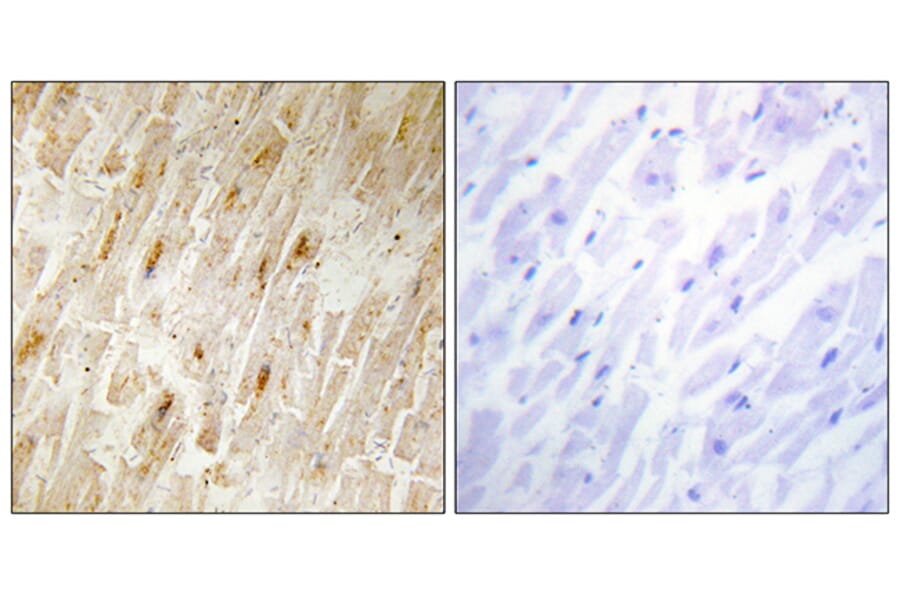 Immunohistochemistry - Anti-BCA3 Antibody (C11741) - Antibodies.com