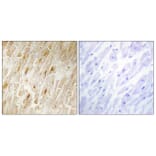 Immunohistochemistry - Anti-BCA3 Antibody (C11741) - Antibodies.com