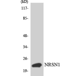 Western Blot - Anti-BCA3 Antibody (R12-2538) - Antibodies.com