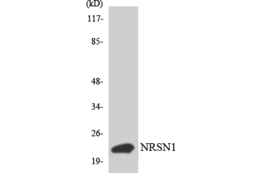 Western Blot - Anti-BCA3 Antibody (R12-2538) - Antibodies.com