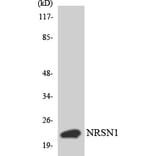 Western Blot - Anti-BCA3 Antibody (R12-2538) - Antibodies.com