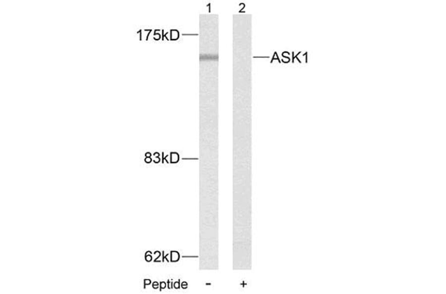 Western Blot - Anti-ASK1 Antibody (B7010) - Antibodies.com