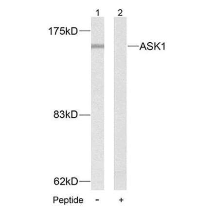 Western Blot - Anti-ASK1 Antibody (B7010) - Antibodies.com