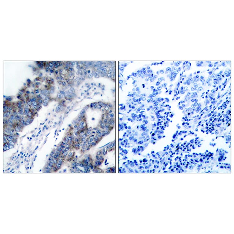 Immunohistochemistry - Anti-ASK1 Antibody (B7010) - Antibodies.com