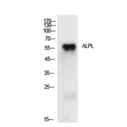 Western Blot - Anti-ALPL Antibody (C30185) - Antibodies.com