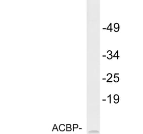 Western Blot - Anti-ACBP Antibody (R12-2003) - Antibodies.com