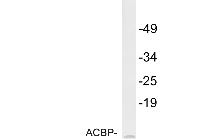 Western Blot - Anti-ACBP Antibody (R12-2003) - Antibodies.com