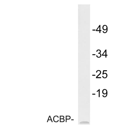 Western Blot - Anti-ACBP Antibody (R12-2003) - Antibodies.com