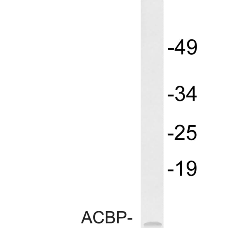 Western Blot - Anti-ACBP Antibody (R12-2003) - Antibodies.com