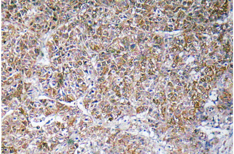 Immunohistochemistry - Anti-ACBP Antibody (R12-2003) - Antibodies.com