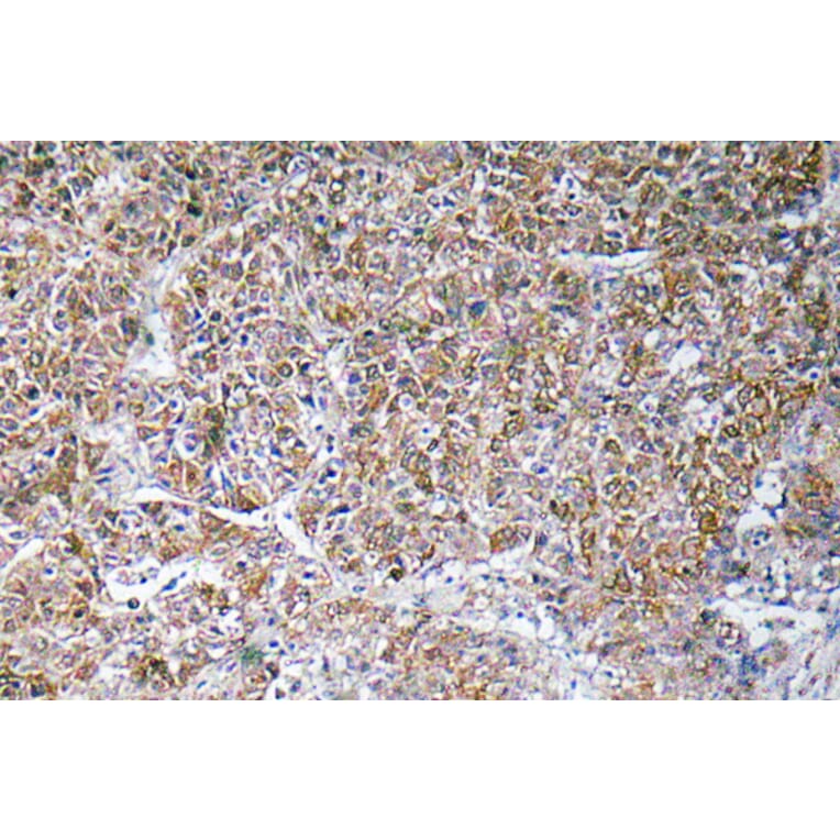 Immunohistochemistry - Anti-ACBP Antibody (R12-2003) - Antibodies.com