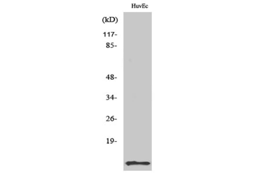 Western Blot - Anti-ACBP Antibody (R12-2003) - Antibodies.com