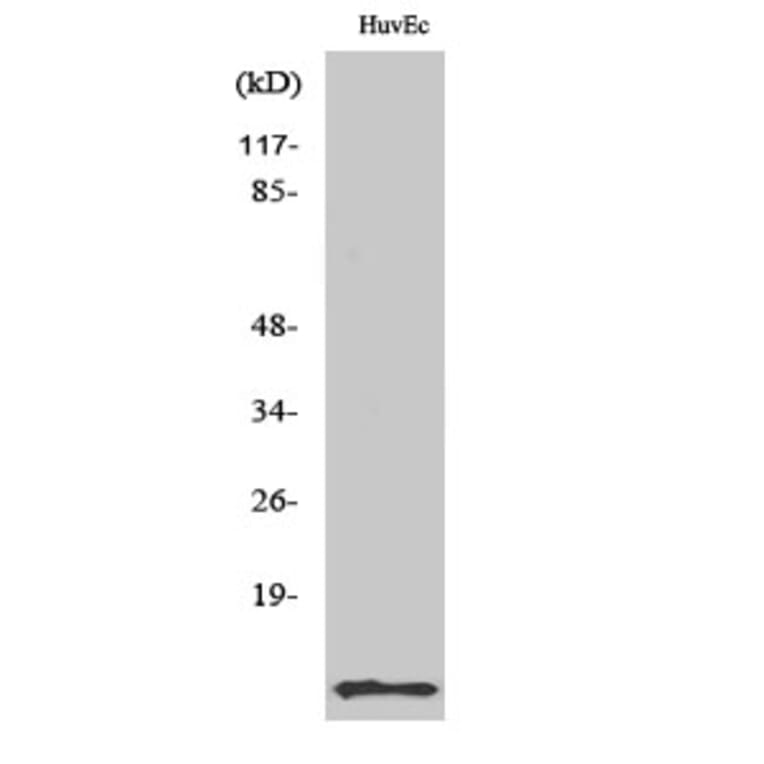 Western Blot - Anti-ACBP Antibody (R12-2003) - Antibodies.com