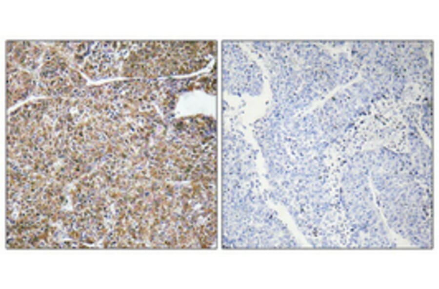 Immunohistochemistry - Anti-ACBP Antibody (R12-2003) - Antibodies.com