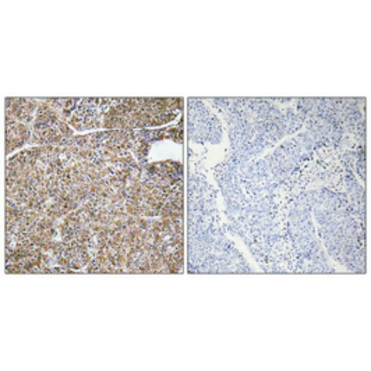 Immunohistochemistry - Anti-ACBP Antibody (R12-2003) - Antibodies.com