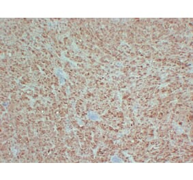 Immunohistochemistry - Anti-S100 Antibody (V0123) - Antibodies.com