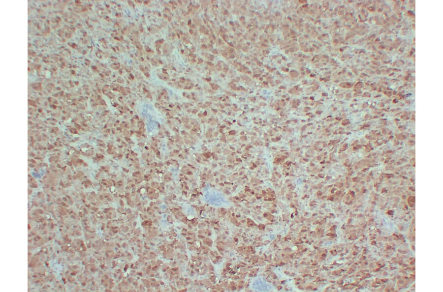 Immunohistochemistry - Anti-S100 Antibody (V0123) - Antibodies.com