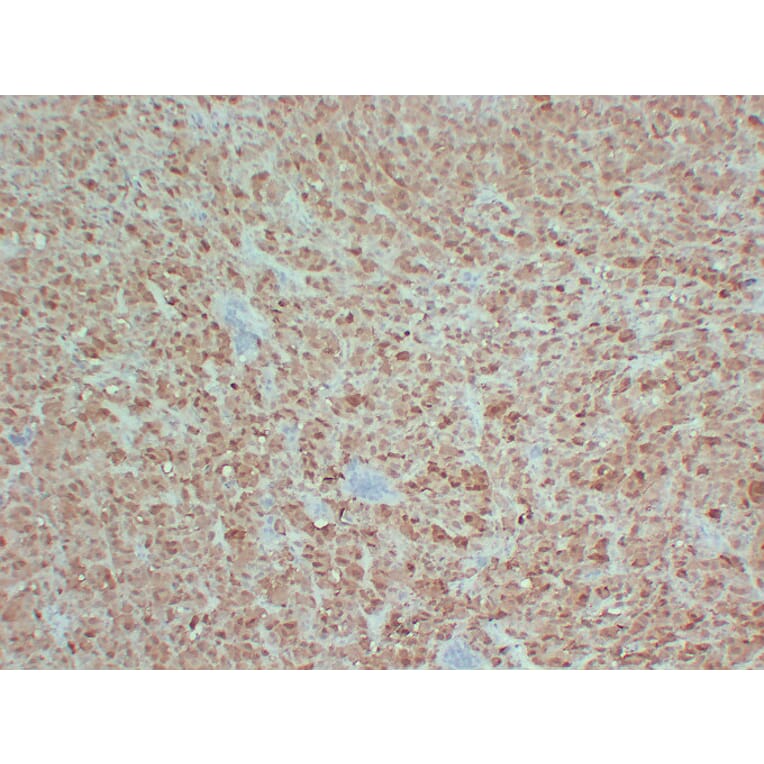 Immunohistochemistry - Anti-S100 Antibody (V0123) - Antibodies.com