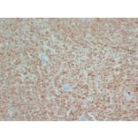 Immunohistochemistry - Anti-S100 Antibody (V0123) - Antibodies.com