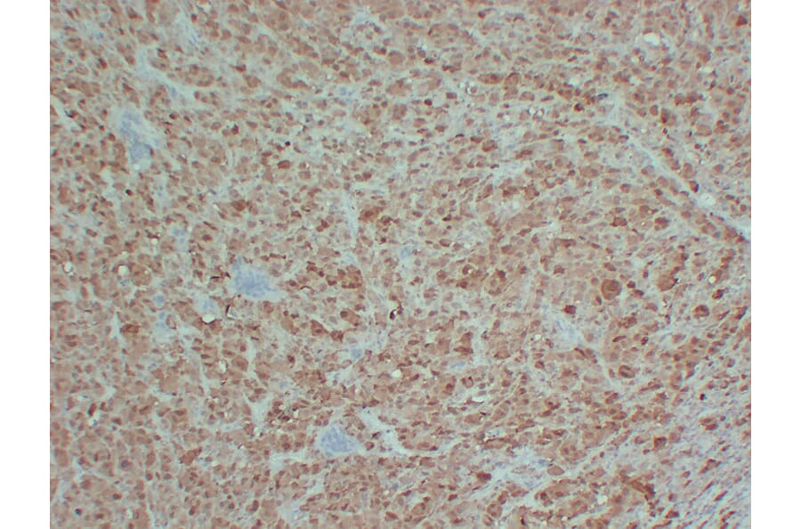 Immunohistochemistry - Anti-S100 Antibody (V0123) - Antibodies.com