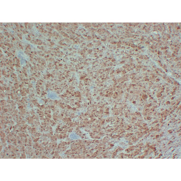 Immunohistochemistry - Anti-S100 Antibody (V0123) - Antibodies.com