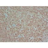 Immunohistochemistry - Anti-S100 Antibody (V0123) - Antibodies.com
