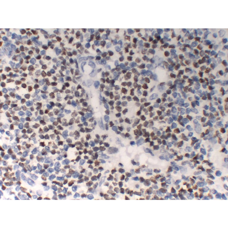 Immunohistochemistry - Anti-OCT2 Antibody (V0105) - Antibodies.com