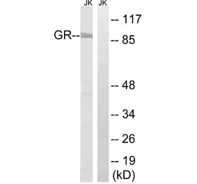 Western Blot - Anti-GR Antibody (B8038) - Antibodies.com