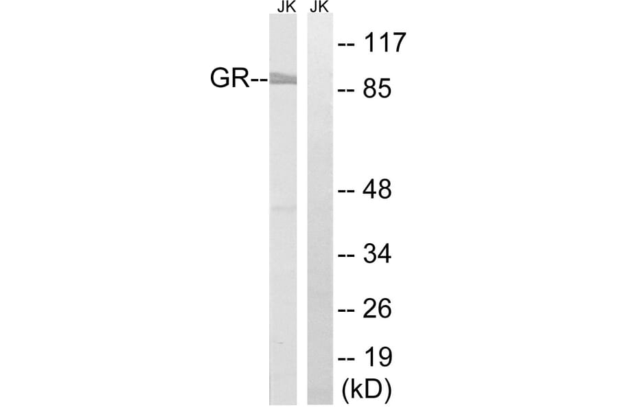 Western Blot - Anti-GR Antibody (B8038) - Antibodies.com