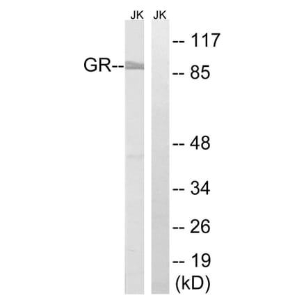 Western Blot - Anti-GR Antibody (B8038) - Antibodies.com