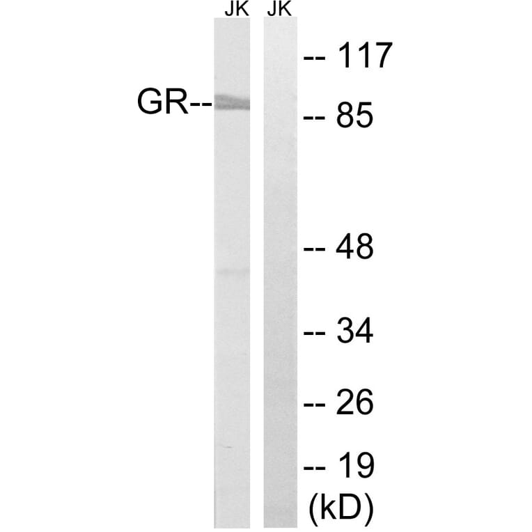 Western Blot - Anti-GR Antibody (B8038) - Antibodies.com