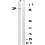 Western Blot - Anti-GR Antibody (B8038) - Antibodies.com