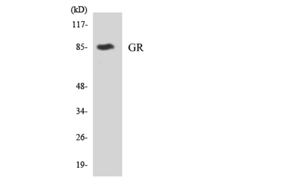 Western Blot - Anti-GR Antibody (R12-2852) - Antibodies.com
