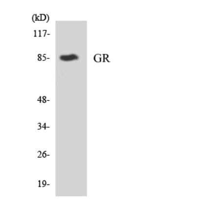 Western Blot - Anti-GR Antibody (R12-2852) - Antibodies.com
