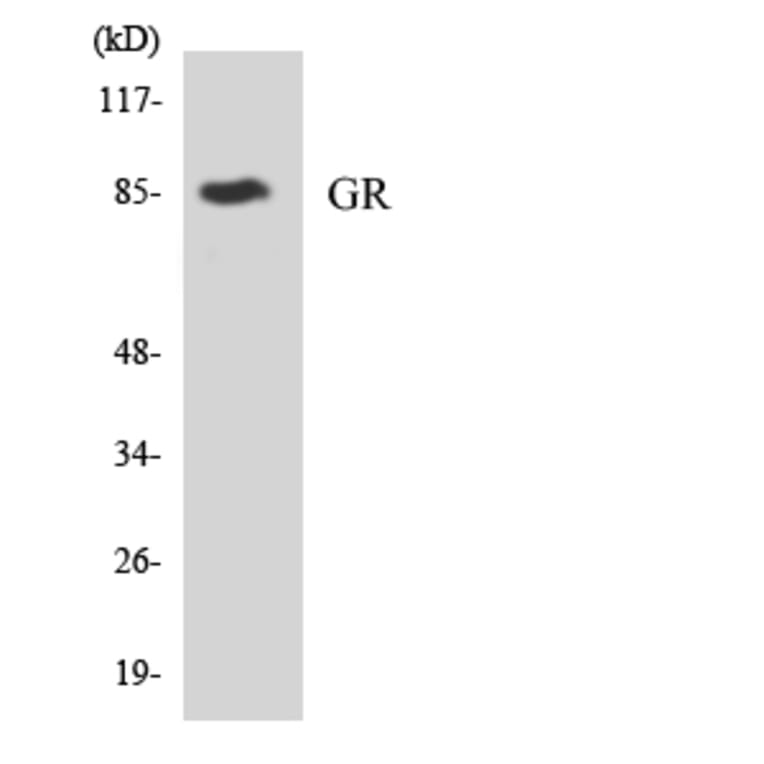 Western Blot - Anti-GR Antibody (R12-2852) - Antibodies.com
