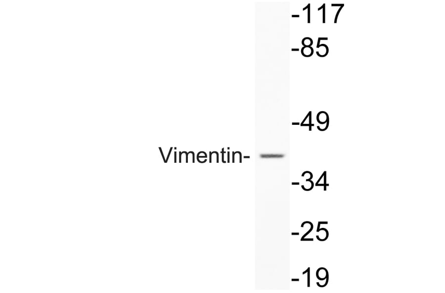 Western Blot - Anti-Vimentin Antibody (R12-2409) - Antibodies.com