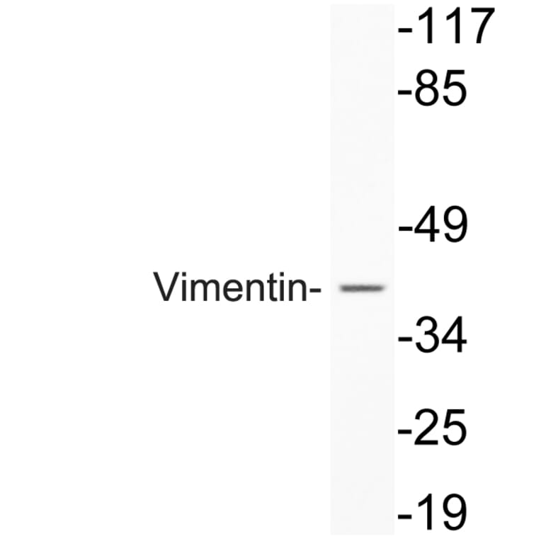 Western Blot - Anti-Vimentin Antibody (R12-2409) - Antibodies.com