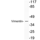 Western Blot - Anti-Vimentin Antibody (R12-2409) - Antibodies.com