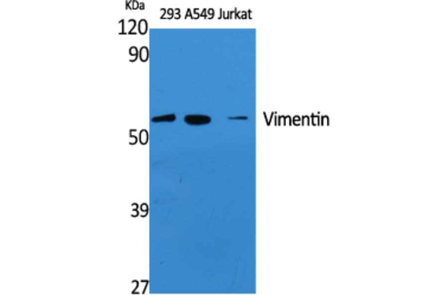 Western Blot - Anti-Vimentin Antibody (R12-2409) - Antibodies.com