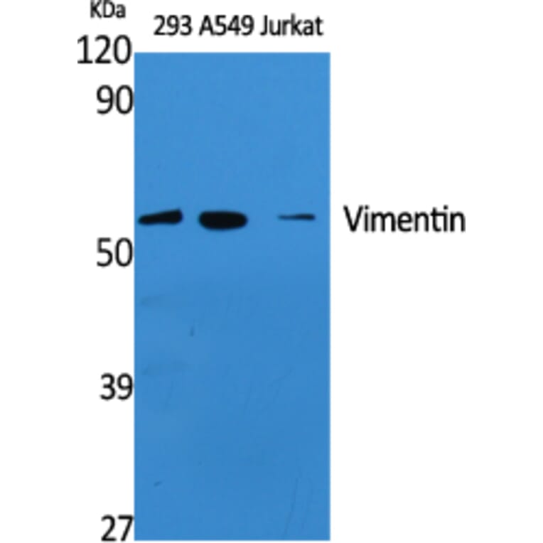 Western Blot - Anti-Vimentin Antibody (R12-2409) - Antibodies.com