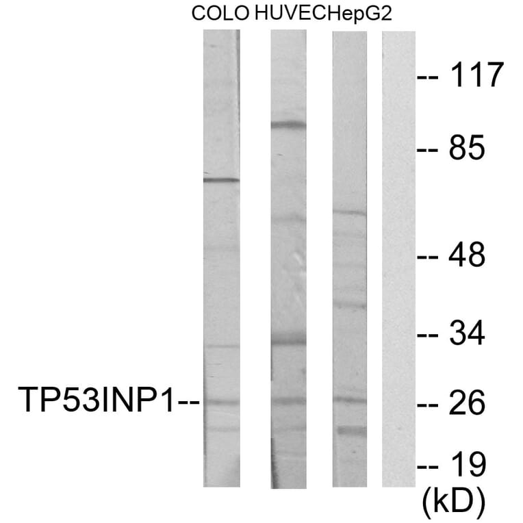 Western Blot - Anti-TP53INP1 Antibody (C11471) - Antibodies.com